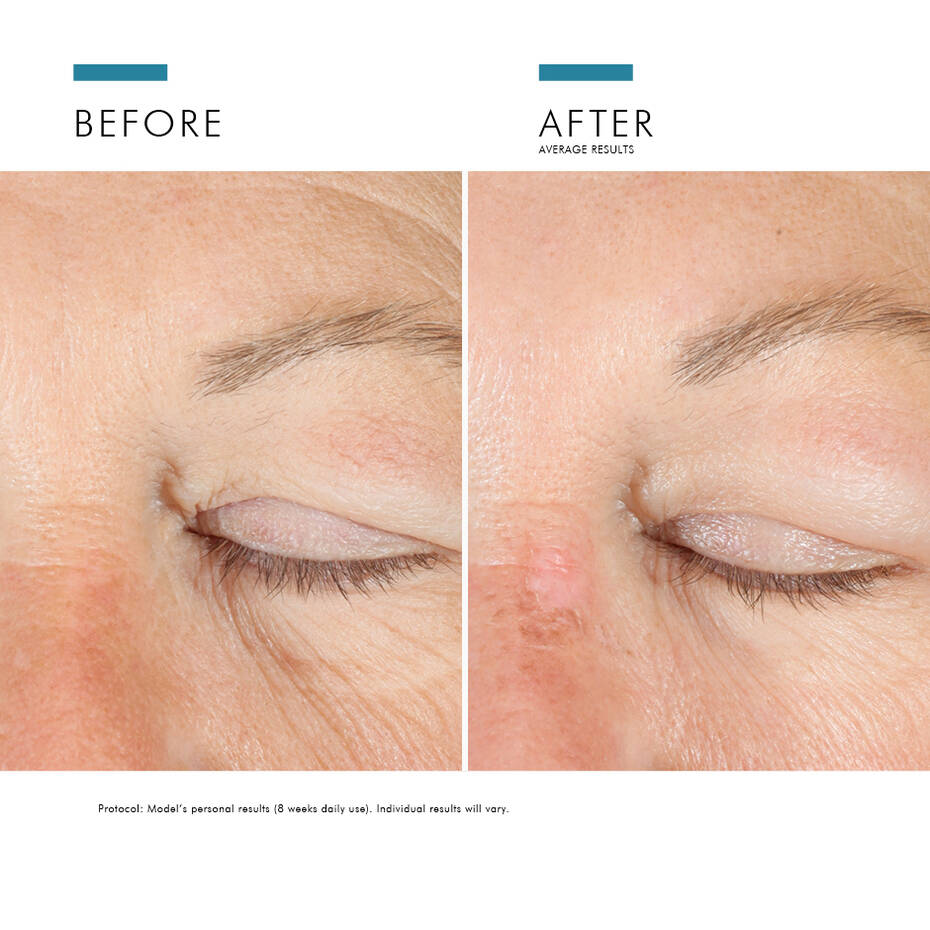 A.G.E Advance Eyes - Imagen 5