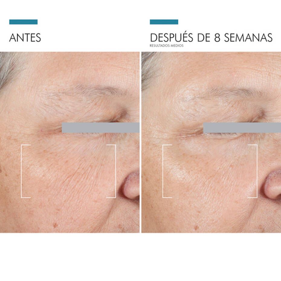 A.G.E Advance Eyes - Imagen 4